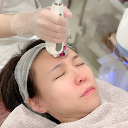 エレクトロポレーションケアシス