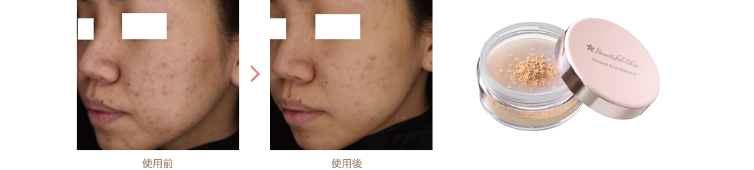 ミネラルファンデーション