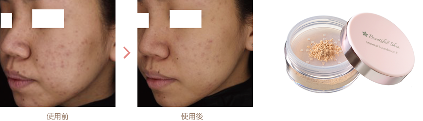 ミネラルファンデーション