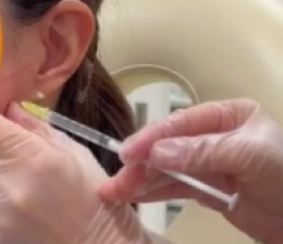 レーザーシャワー