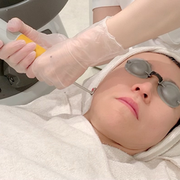 レーザーシャワー