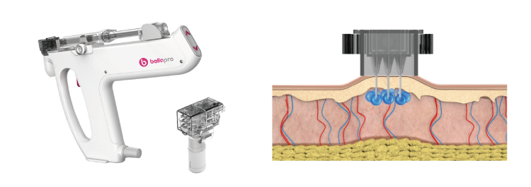ウルトラセルQプラス