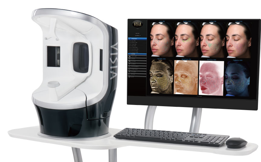 肌画像診断機VISIA
