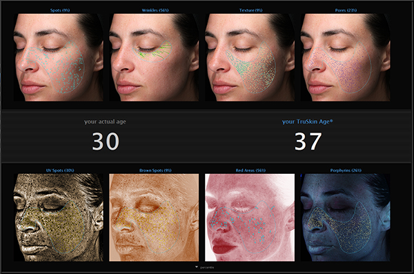 VISIAの解析項目