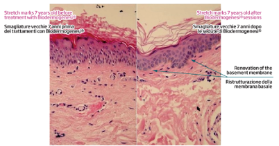 ウルトラセルQプラス