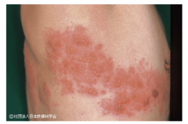 皮膚科・アレルギー科