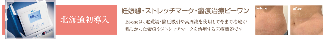 妊娠線・ストレッチマーク・瘢痕治療ビーワンを白石ガーデンプレイス皮膚科クリニックが北海道初導入。Bi-oneは、電磁場・陰圧吸入や高周波を使用して今まで治療が難しかった瘢痕やストレッチマークを治療する医療機器です。