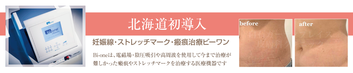 妊娠線・ストレッチマーク・瘢痕治療ビーワンを白石ガーデンプレイス皮膚科クリニックが北海道初導入。Bi-oneは、電磁場・陰圧吸入や高周波を使用して今まで治療が難しかった瘢痕やストレッチマークを治療する医療機器です。