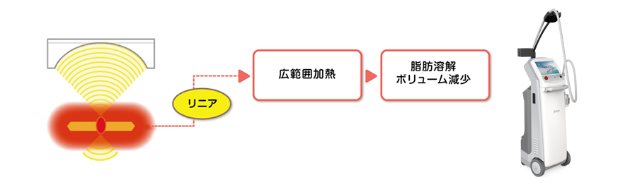 ウルトラセルQプラスリニア
