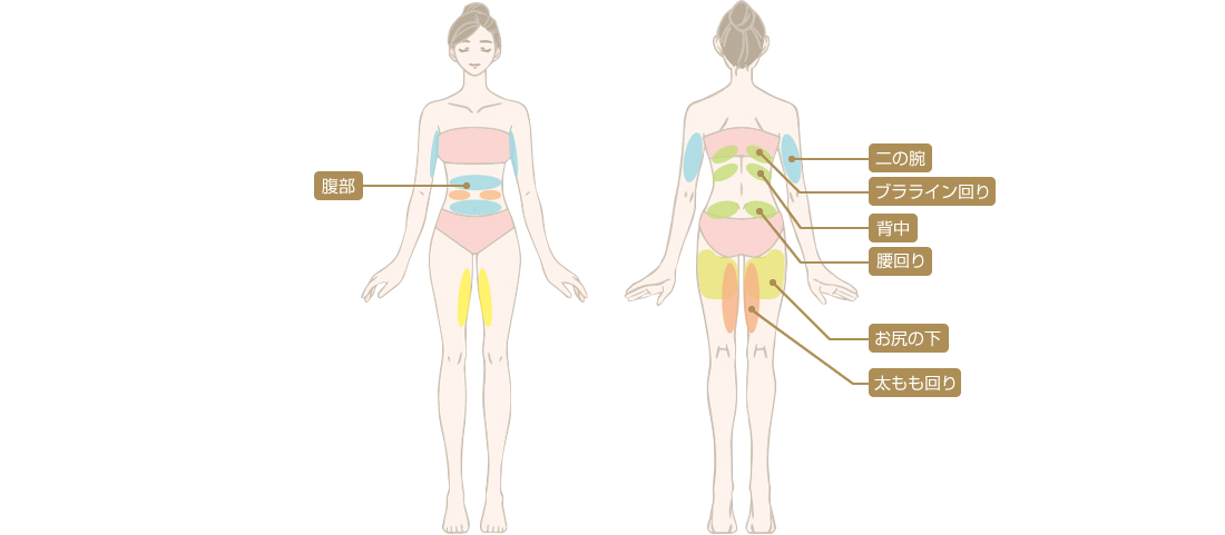 医療ダイエットで痩身できる部位