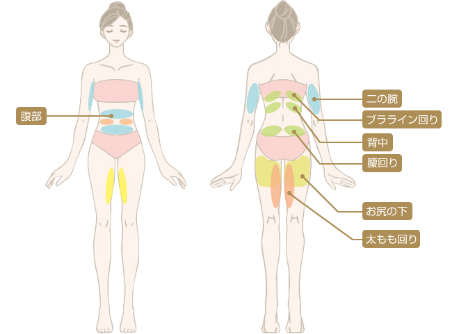 医療ダイエットで痩身できる部位