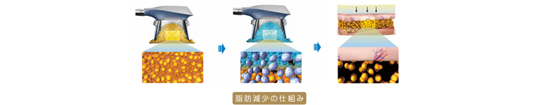 脂肪減少の仕組み