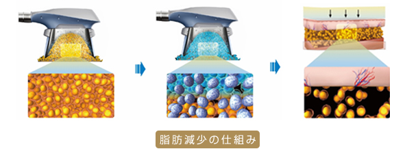脂肪減少の仕組み