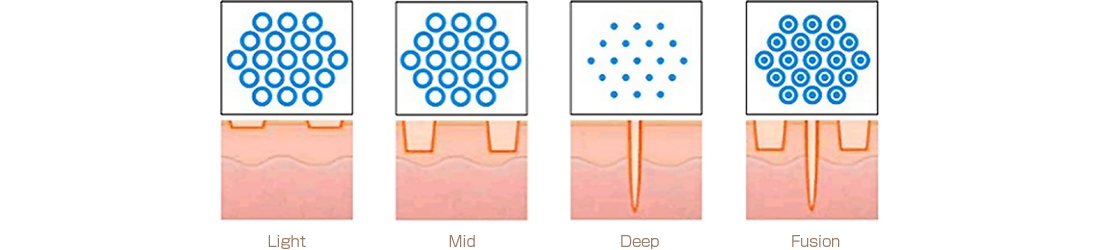 フラクショナルモード