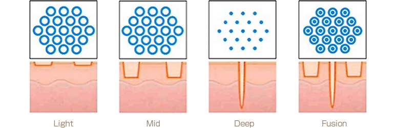 フラクショナルモード
